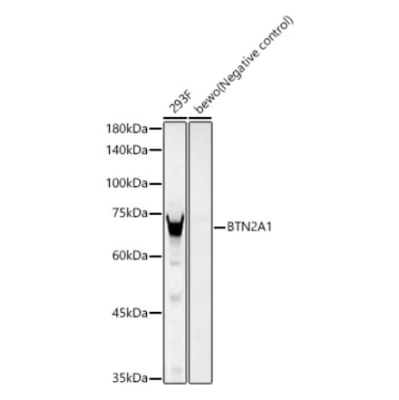 Western Blot - Anti-BTN2A1 Antibody [ARC59656] (A309786) - Antibodies.com
