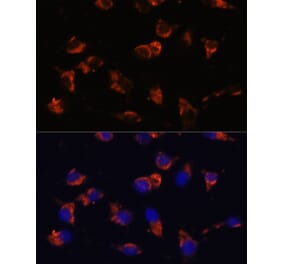 Immunofluorescence - Anti-CA19-9 Antibody [AMC0043] (A309787) - Antibodies.com