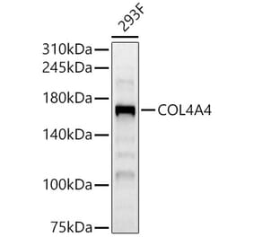 Western Blot - Anti-Collagen IV Antibody (A309788) - Antibodies.com