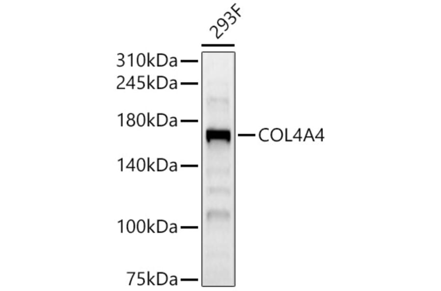 Western Blot - Anti-Collagen IV Antibody (A309788) - Antibodies.com