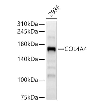 Western Blot - Anti-Collagen IV Antibody (A309788) - Antibodies.com