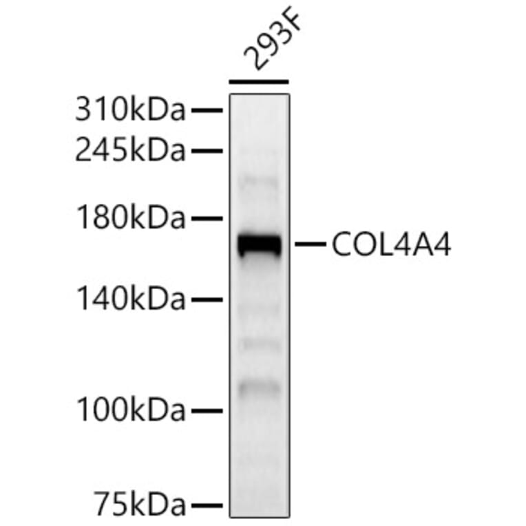 Western Blot - Anti-Collagen IV Antibody (A309788) - Antibodies.com