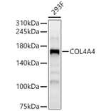 Western Blot - Anti-Collagen IV Antibody (A309788) - Antibodies.com