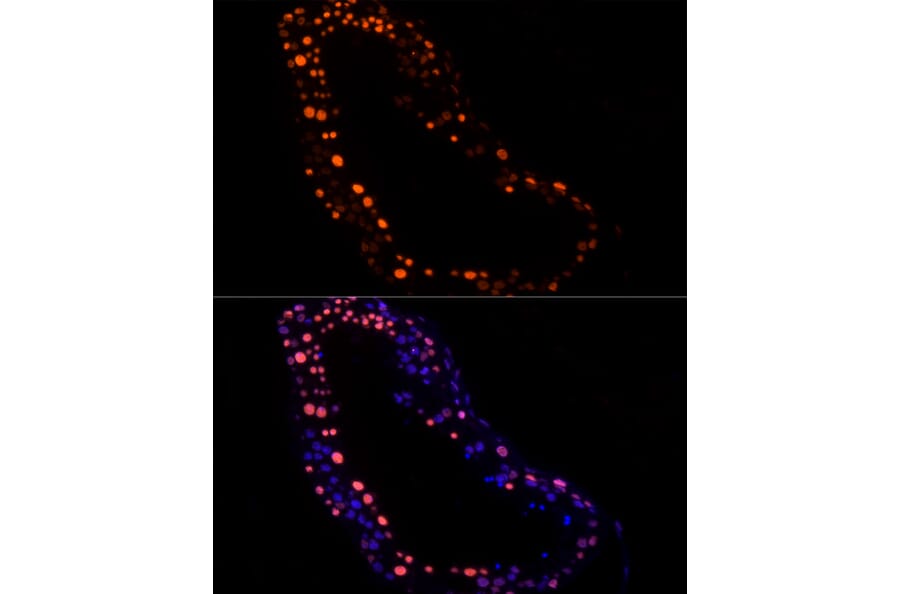 Immunofluorescence - Anti-hnRNP G-T Antibody [ARC2922] (A309791) - Antibodies.com