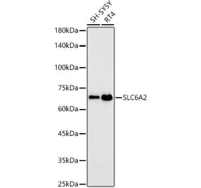 Western Blot - Anti-Noradrenaline transporter Antibody [ARC58596] (A309792) - Antibodies.com
