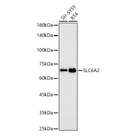 Western Blot - Anti-Noradrenaline transporter Antibody [ARC58596] (A309792) - Antibodies.com