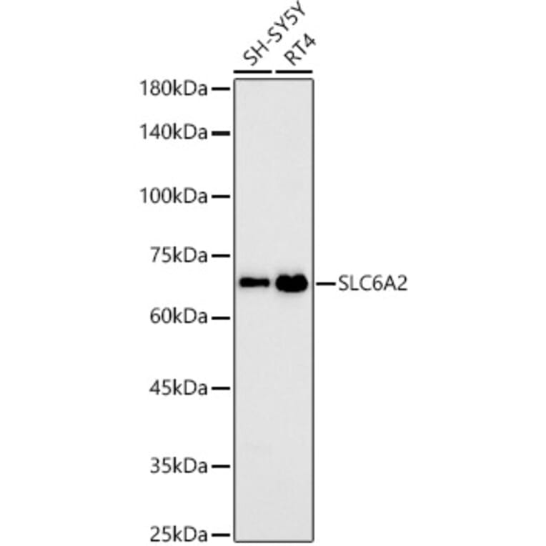 Western Blot - Anti-Noradrenaline transporter Antibody [ARC58596] (A309792) - Antibodies.com
