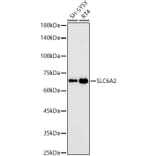 Western Blot - Anti-Noradrenaline transporter Antibody [ARC58596] (A309792) - Antibodies.com