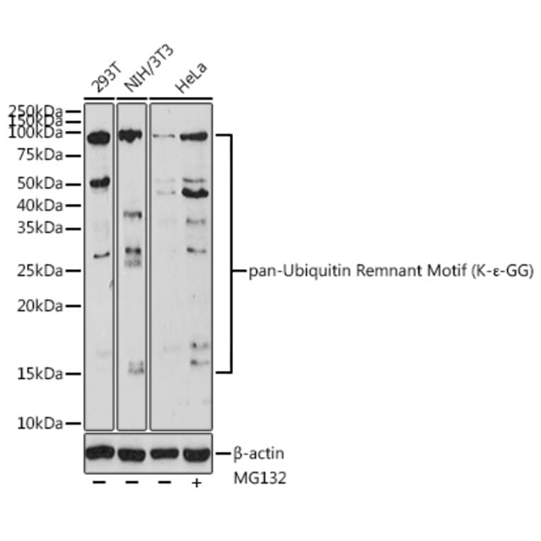 Western Blot - Anti-pan Ubiquitin Remnant Motif (K-e-GG) Antibody (A309793) - Antibodies.com