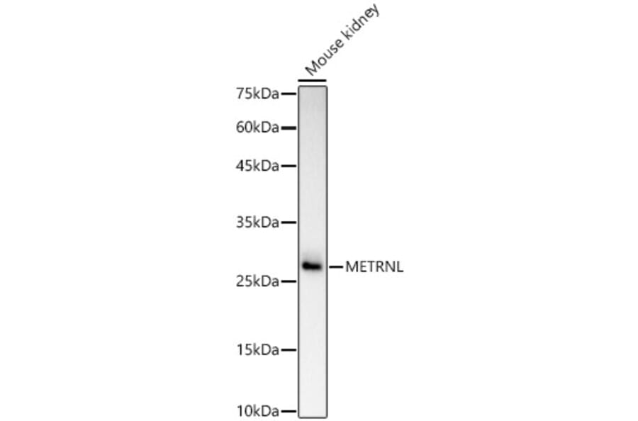 Western Blot - Anti-METRNL Antibody (A309794) - Antibodies.com