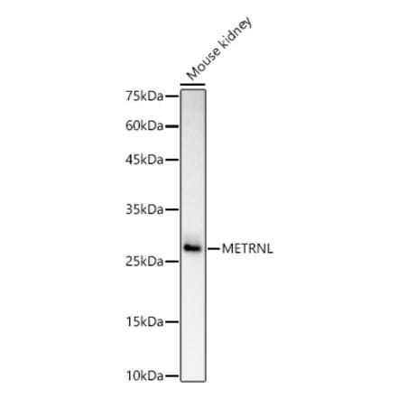 Western Blot - Anti-METRNL Antibody (A309794) - Antibodies.com