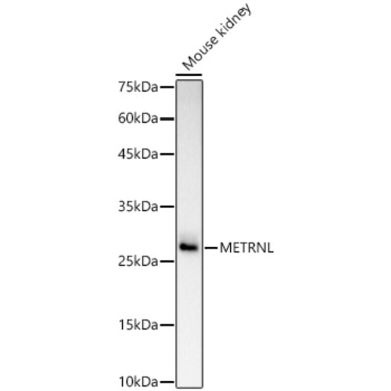 Western Blot - Anti-METRNL Antibody (A309794) - Antibodies.com