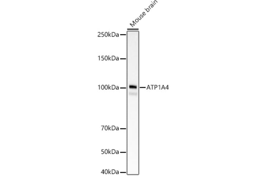Western Blot - Anti-Sodium Potassium ATPase Antibody [ARC59773] (A309795) - Antibodies.com