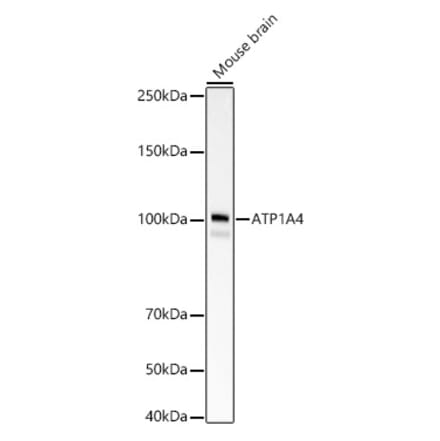 Western Blot - Anti-Sodium Potassium ATPase Antibody [ARC59773] (A309795) - Antibodies.com