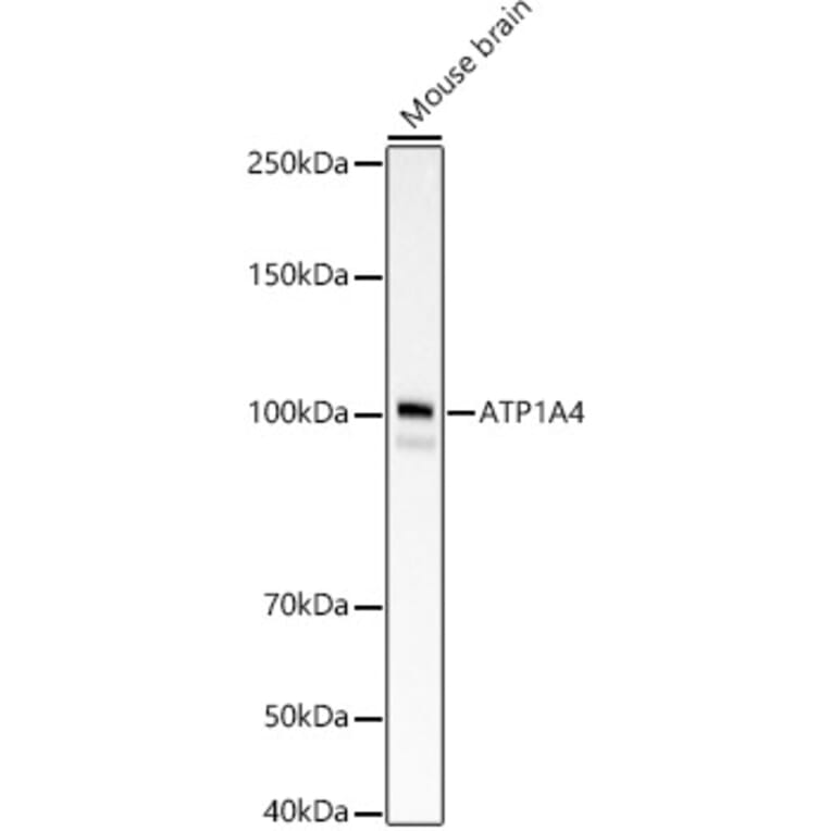 Western Blot - Anti-Sodium Potassium ATPase Antibody [ARC59773] (A309795) - Antibodies.com