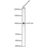 Western Blot - Anti-Sodium Potassium ATPase Antibody [ARC59773] (A309795) - Antibodies.com