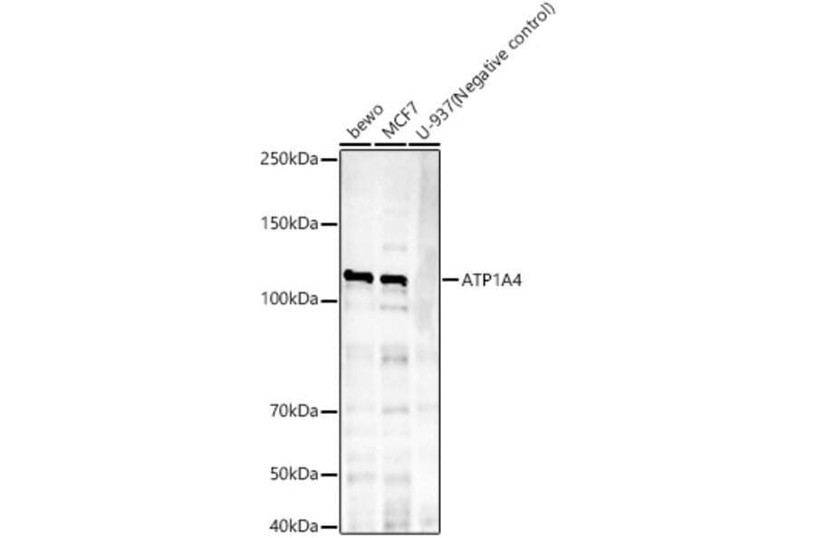 Western Blot - Anti-Sodium Potassium ATPase Antibody [ARC59773] (A309795) - Antibodies.com