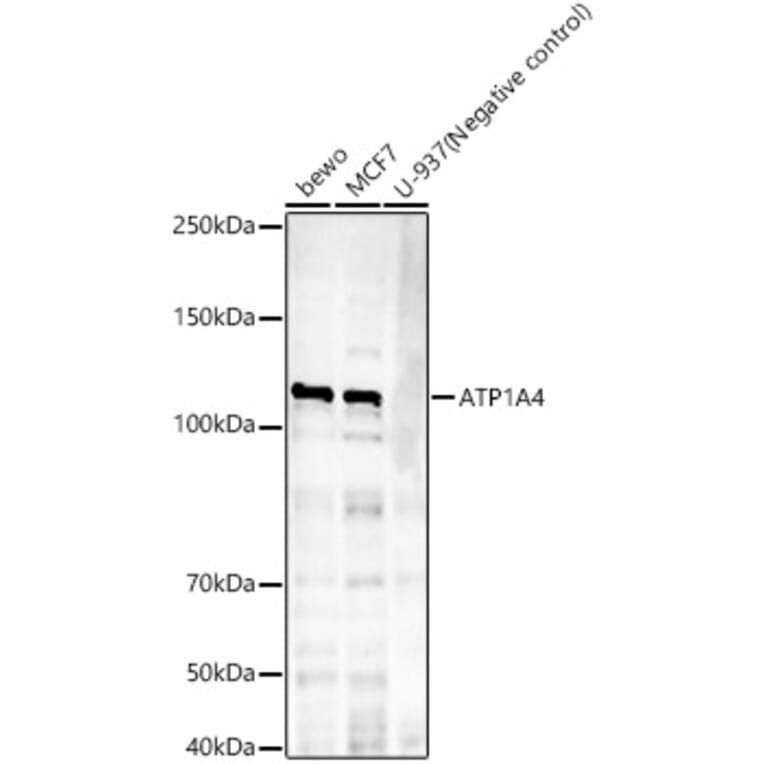 Western Blot - Anti-Sodium Potassium ATPase Antibody [ARC59773] (A309795) - Antibodies.com