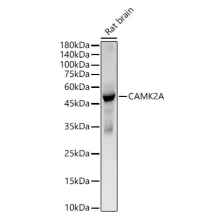 Western Blot - Anti-CaMKII alpha Antibody [ARC57333] (A309796) - Antibodies.com