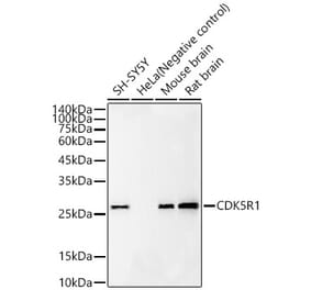 Western Blot - Anti-p35 Antibody [ARC60811] (A309798) - Antibodies.com