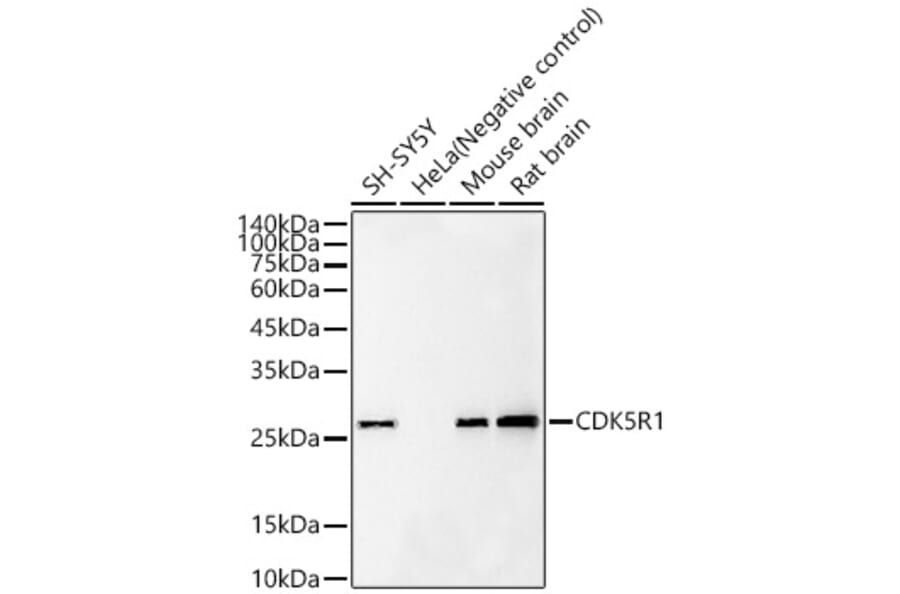 Western Blot - Anti-p35 Antibody [ARC60811] (A309798) - Antibodies.com