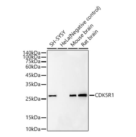 Western Blot - Anti-p35 Antibody [ARC60811] (A309798) - Antibodies.com