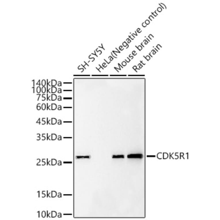 Western Blot - Anti-p35 Antibody [ARC60811] (A309798) - Antibodies.com