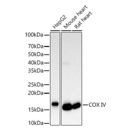 Western Blot - Anti-COX IV Antibody (A309799) - Antibodies.com