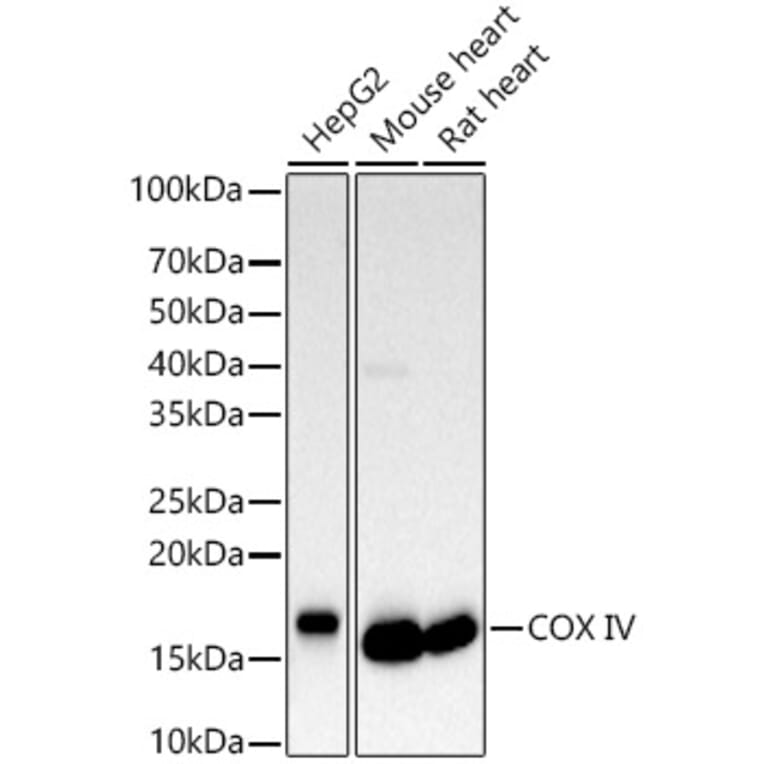 Western Blot - Anti-COX IV Antibody (A309799) - Antibodies.com