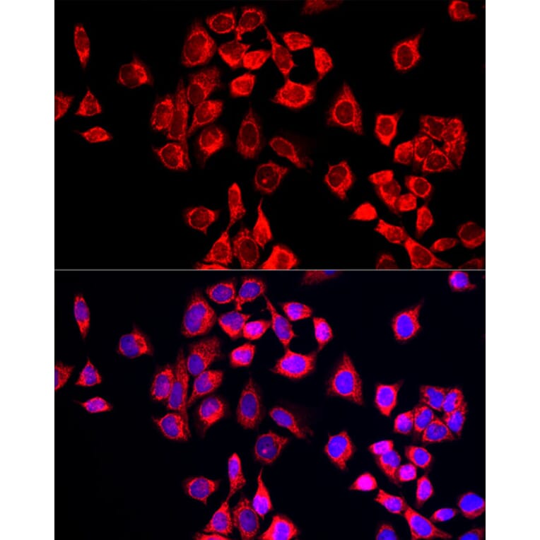 Immunofluorescence - Anti-COX IV Antibody (A309799) - Antibodies.com