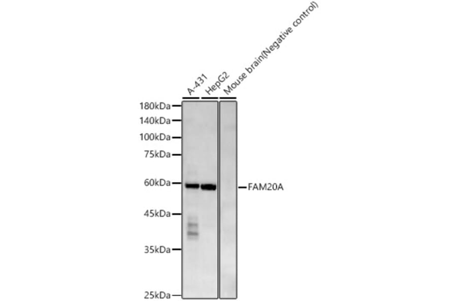 Western Blot - Anti-FAM20A Antibody (A309801) - Antibodies.com