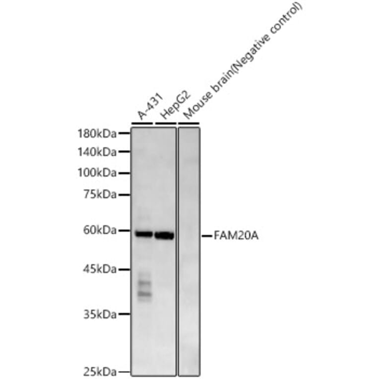 Western Blot - Anti-FAM20A Antibody (A309801) - Antibodies.com