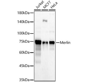Western Blot - Anti-NF2 / Merlin Antibody (A309804) - Antibodies.com