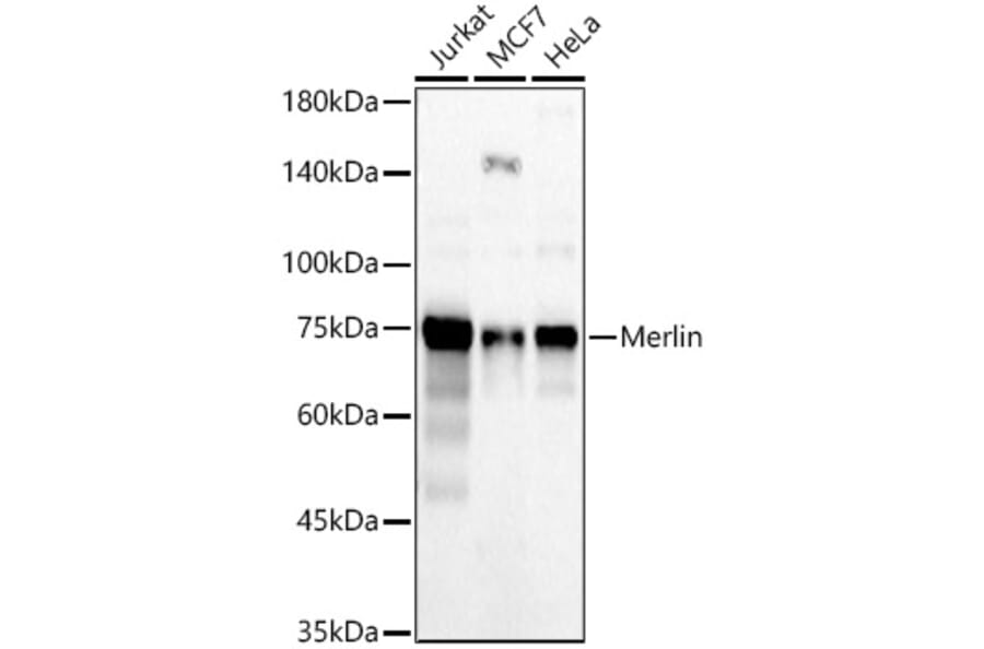 Western Blot - Anti-NF2/Merlin Antibody (A309804) - Antibodies.com