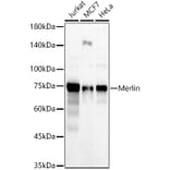 Western Blot - Anti-NF2/Merlin Antibody (A309804) - Antibodies.com