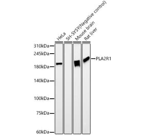 Western Blot - Anti-PLA2R Antibody [ARC59749] (A309806) - Antibodies.com