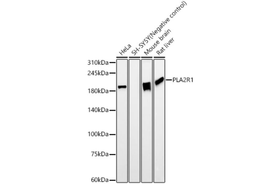 Western Blot - Anti-PLA2R Antibody [ARC59749] (A309806) - Antibodies.com