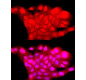 Immunofluorescence - Anti-BRN3A Antibody (A309807) - Antibodies.com