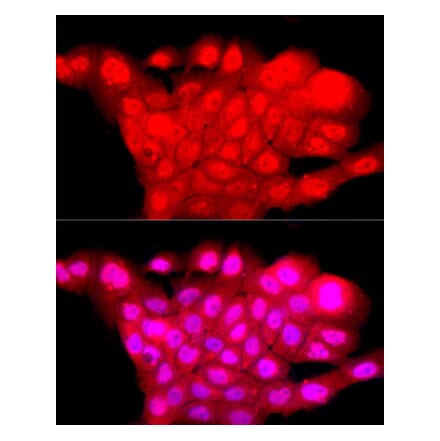 Immunofluorescence - Anti-BRN3A Antibody (A309807) - Antibodies.com