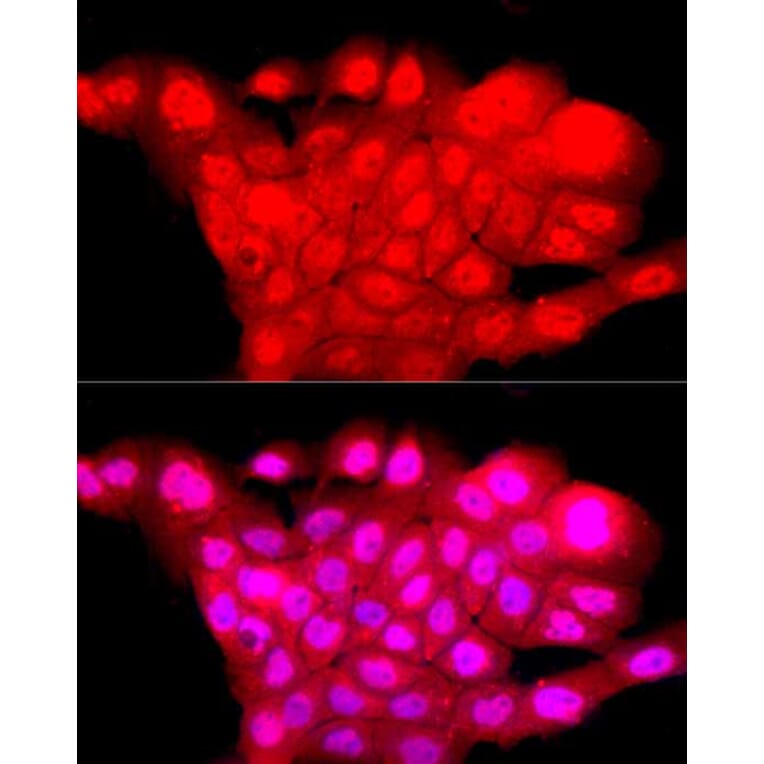 Immunofluorescence - Anti-BRN3A Antibody (A309807) - Antibodies.com
