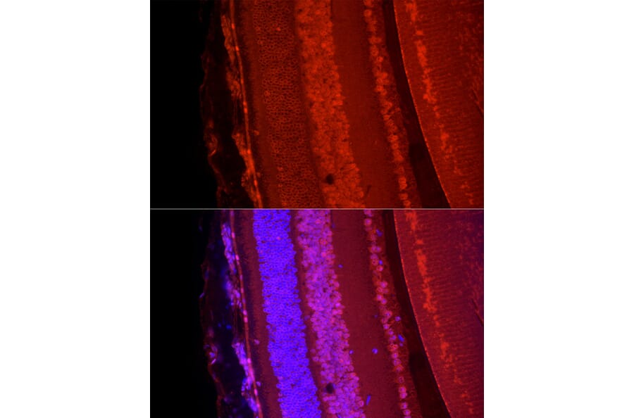 Immunofluorescence - Anti-BRN3A Antibody (A309807) - Antibodies.com