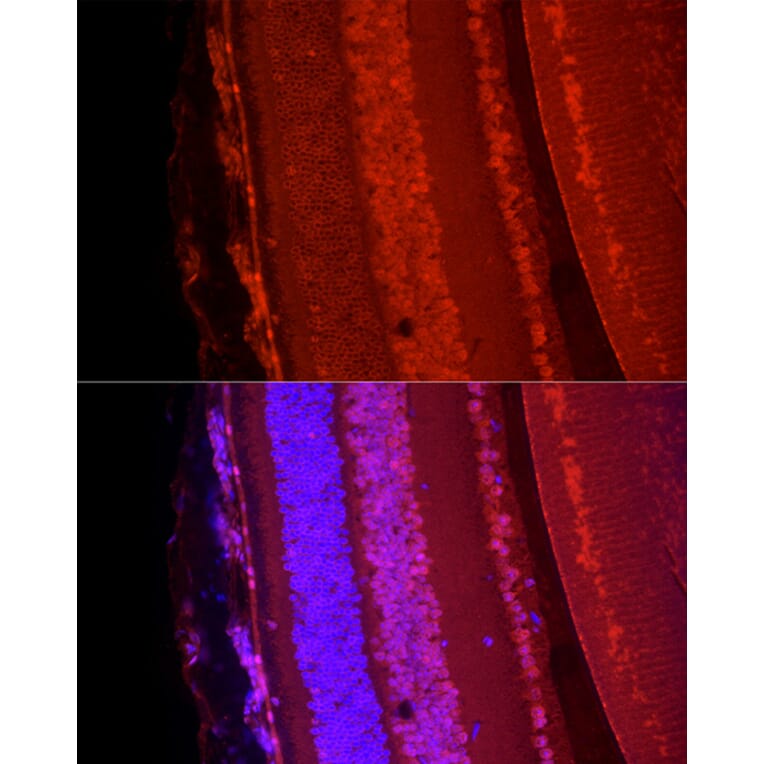 Immunofluorescence - Anti-BRN3A Antibody (A309807) - Antibodies.com