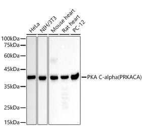 Western Blot - Anti-cAMP Protein Kinase Catalytic subunit Antibody [AMC0275] (A309808) - Antibodies.com