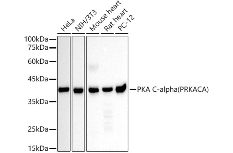 Western Blot - Anti-cAMP Protein Kinase Catalytic subunit Antibody (A309808) - Antibodies.com
