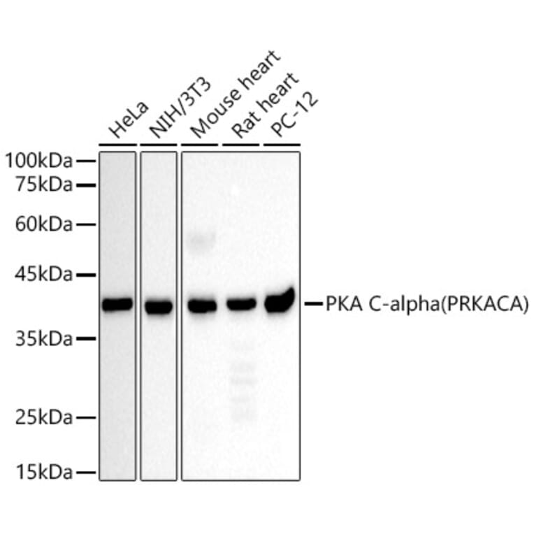 Western Blot - Anti-cAMP Protein Kinase Catalytic subunit Antibody (A309808) - Antibodies.com