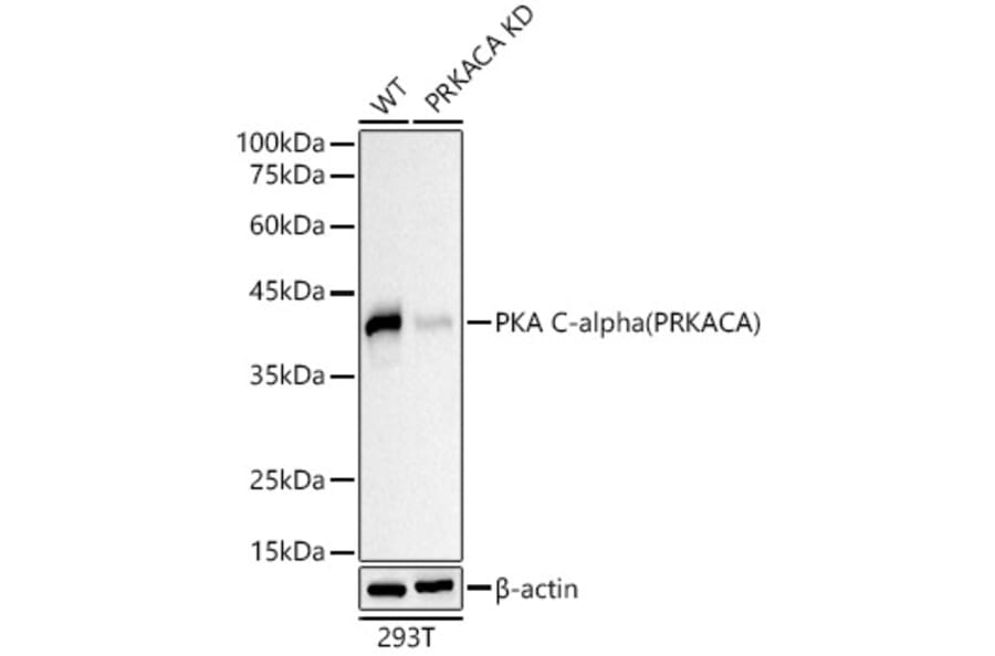 Western Blot - Anti-cAMP Protein Kinase Catalytic subunit Antibody (A309808) - Antibodies.com