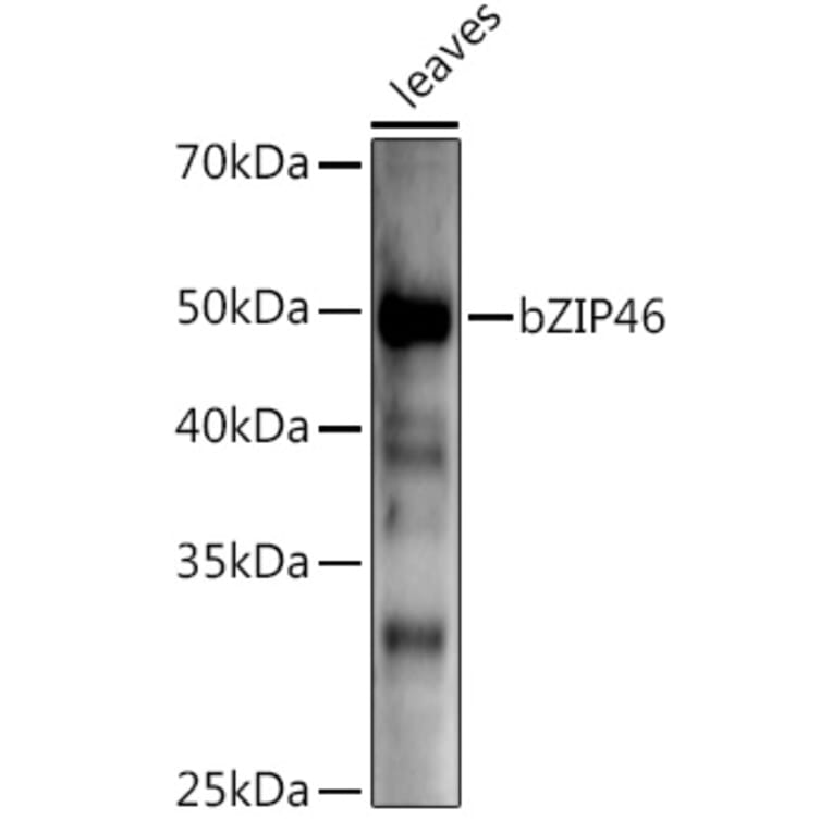 Western Blot - Anti-BZIP46 Antibody (A309815) - Antibodies.com