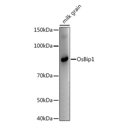 Western Blot - Anti-BIP1 Antibody (A309819) - Antibodies.com