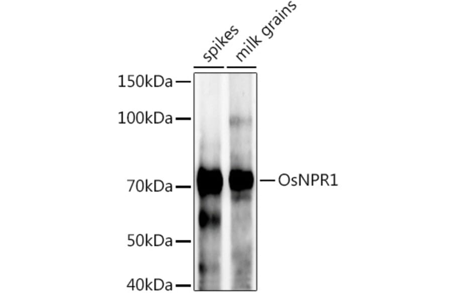 Western Blot - Anti-NPR1 Antibody (A309834) - Antibodies.com