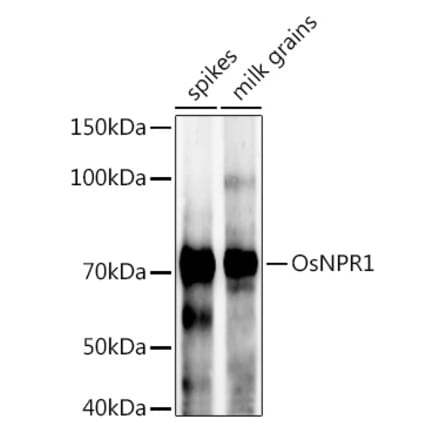 Western Blot - Anti-NPR1 Antibody (A309834) - Antibodies.com